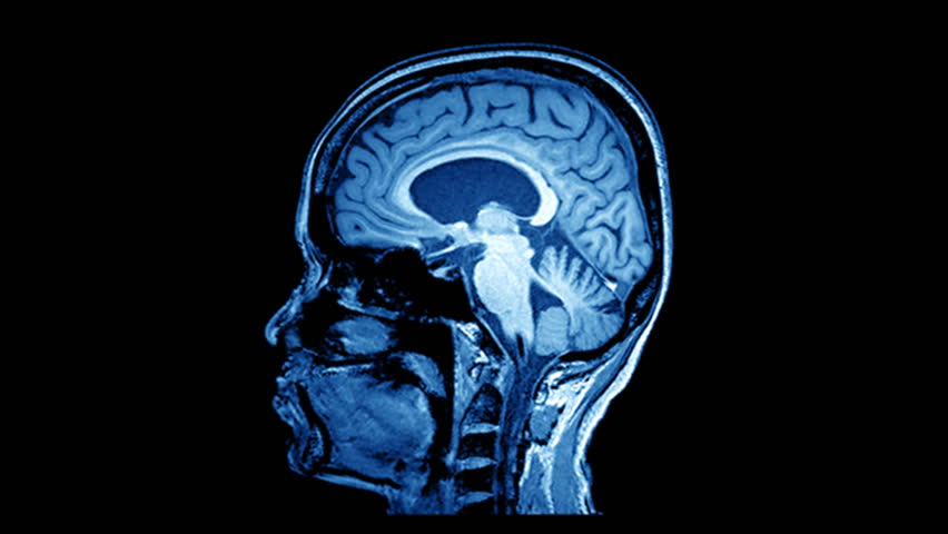 “Human Soul” to be Scanned by Most Powerful MRI