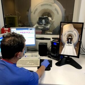 MRI Patient Motion Tracker